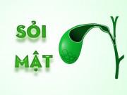 Sức khỏe - Không muốn bị sỏi mật "đeo bám", cần nắm chắc những kiến thức này