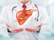 Sức khỏe - Viêm gan C - căn bệnh nguy hiểm có thể đe dọa tính mạng nhiều người