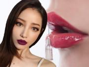 Đẹp - Cần biết gì trước khi quyết định bơm filler để tránh những đôi môi thảm họa?