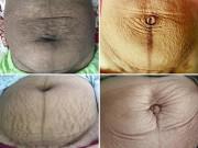 Bà bầu - Sau sinh mẹ được gì? - Em bé như thiên thần và vùng bụng như thửa ruộng "cằn cỗi"