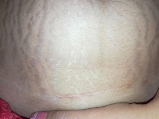 Sau sinh mẹ được gì? - Em bé như thiên thần và vùng bụng như thửa ruộng amp;#34;cằn cỗiamp;#34; - 4