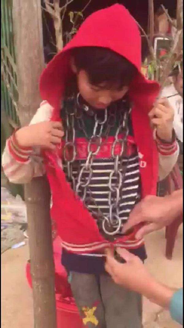 Đã có hình thức xử lý người chú xích cổ cháu ruột ở Thanh Hóa - 1