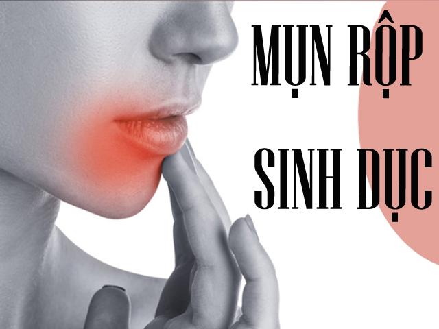 Mụn rộp sinh dục - căn bệnh không của riêng ai