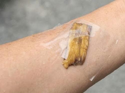 Đắp 3 amp;#34;thần dượcamp;#34; này mỗi ngày, bạn sẽ không bao giờ biết đến mụn cóc ở chân là gì! - 4