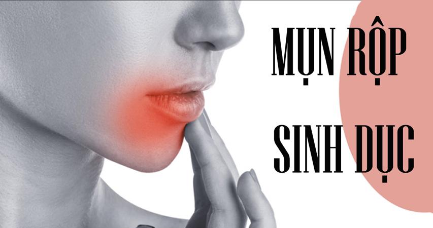 Mụn rộp sinh dục - căn bệnh không của riêng ai - 1