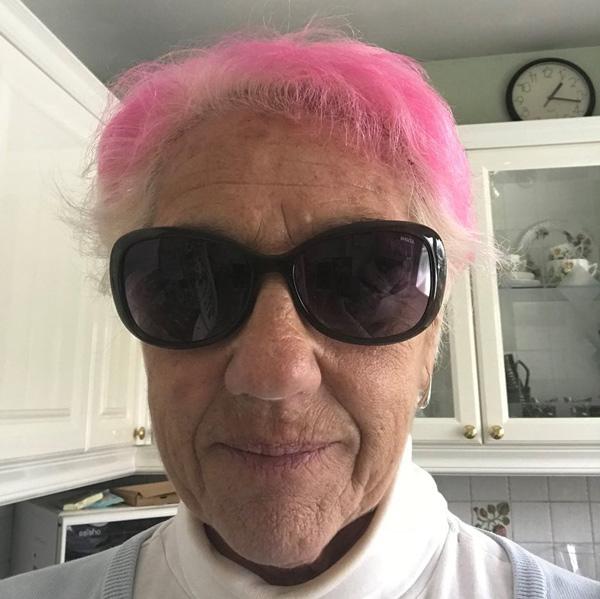 Phẫu thuật mắt bằng laser, người phụ nữ bị amp;#34;đốt cháyamp;#34; luôn võng mạc - 3