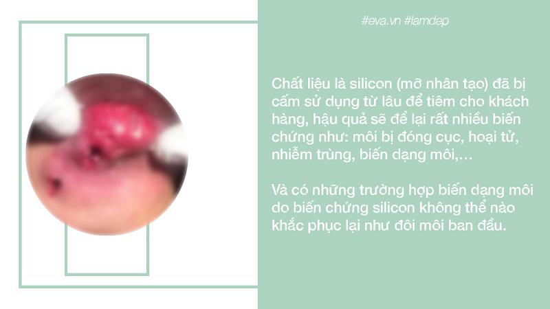 Trong trường hợp đó hãy nhanh chóng đến bệnh viện làm kiểm tra.
