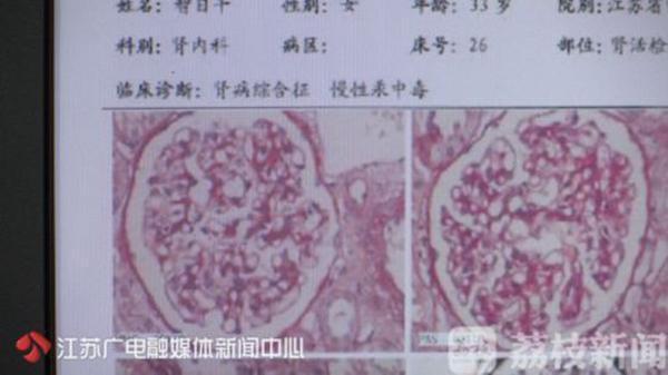 Đua theo trào lưu tắm trắng bằng mỹ phẩm giá rẻ, người phụ nữ bị ngộ độc trầm trọng - 2