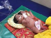 Tin tức - Không đi siêu âm thai, mẹ khóc nghẹn khi thấy con chào đời có 2 đầu