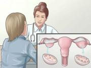 Sức khỏe - Đa nang buồng trứng có nguy hiểm không?