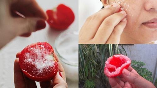 5 cách trị mụn bọc tại nhà dù mụn có to đến đâu cũng xẹp lép chỉ sau 1 đêm - 2