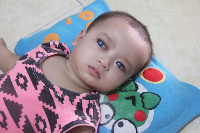 Câu chuyện buồn sau đôi mắt màu xanh đẹp tựa thiên thần của bé trai 6 tháng tuổi - 1