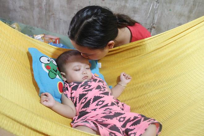 Câu chuyện buồn sau đôi mắt màu xanh đẹp tựa thiên thần của bé trai 6 tháng tuổi - 2