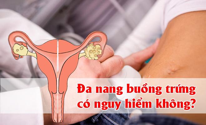 Đa nang buồng trứng có nguy hiểm không? - 1
