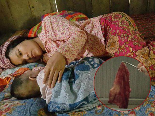 Sau sinh 3 tháng vẫn âm ỉ đau bụng, bà mẹ tá hỏa khi phát hiện sự thật