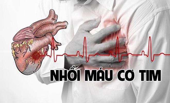 Đề phòng nhồi máu cơ tim có thể gây hại cho tính mạng bất cứ lúc nào - 1