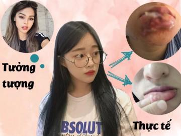 1001 thảm họa lợn lành hóa què khiến chị em phải suy nghĩ kĩ trước khi bơm môi!