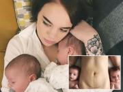 Bà bầu - Không buồn, không tủi, đây là cách bà mẹ hai con nghĩ về vết bụng rạn sau sinh