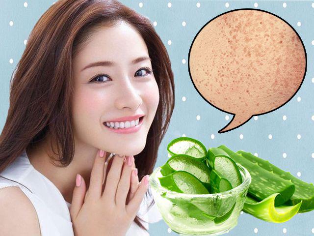 Tìm lại làn da trắng khoẻ bằng cách trị nám hiệu quả và dứt điểm tại nhà