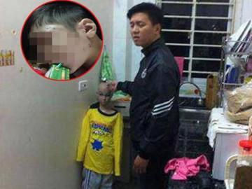 Vụ bé trai 10 tuổi bị cha đẻ, mẹ kế bạo hành: Giật mình kết quả giám định thương tật