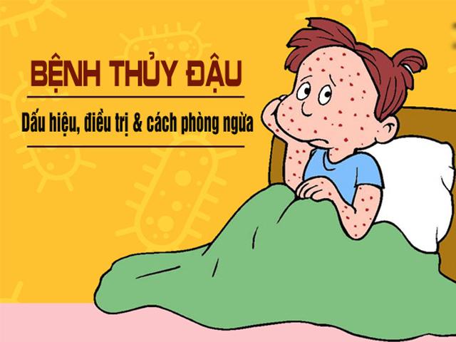 Khi trẻ bị thủy đậu, thứ tự phát ban các nốt bỏng rạ sẽ như thế nào?