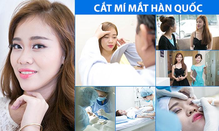 Giải đáp thắc mắc của hàng ngàn chị em với câu hỏi:amp;#34;Cắt mí mắt có hại không?amp;#34; - 4