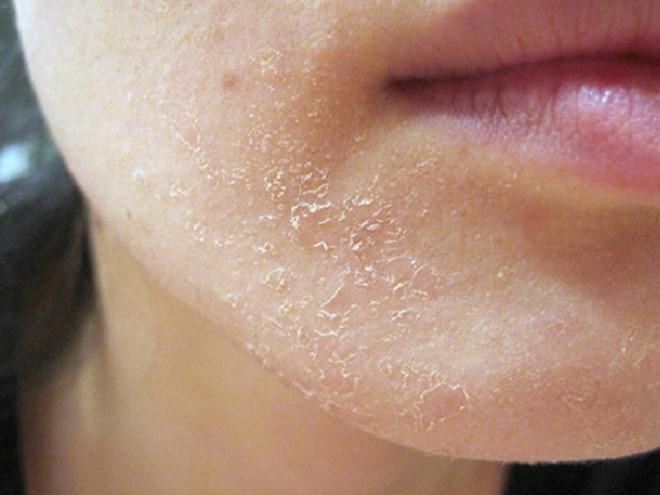 Mách nhỏ nàng cách đắp mặt nạ cà chua an toàn, hiệu quả mà lại đơn giản và tiết kiệm - 2