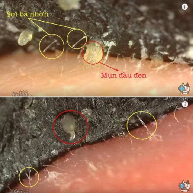 ai con dung vaseline hay mat na than hoat tinh de lot mun cam thi dung tay lai nhanh! - 10