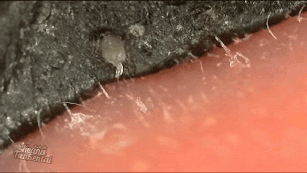 ai con dung vaseline hay mat na than hoat tinh de lot mun cam thi dung tay lai nhanh! - 8