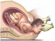 Tin tức - “Chửa đẻ - cửa mả, làm thế nào tôn trọng tự nhiên, nhưng không bất chấp tất cả”