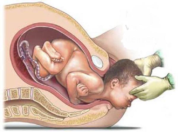 “Chửa đẻ - cửa mả, làm thế nào tôn trọng tự nhiên, nhưng không bất chấp tất cả” - 3