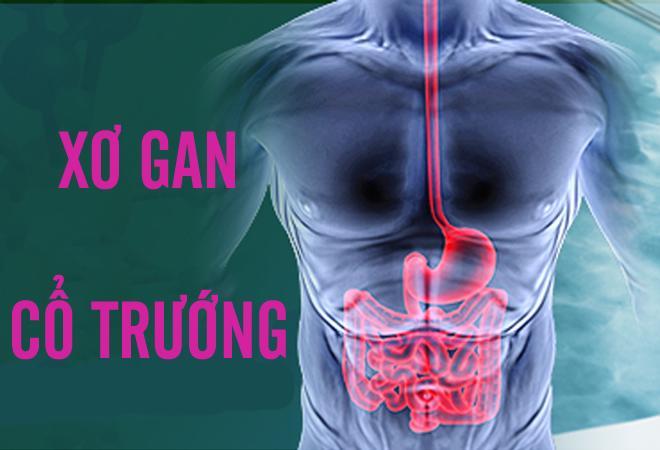 Dừng ngay việc uống rượu bia nếu không muốn bị xơ gan cổ trướng - 1
