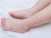 Làm mẹ - Những tác nhân nguy hiểm dễ khiến trẻ bị dị ứng