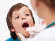 Yêu con - Viêm amidan ở trẻ: Dấu hiệu, nguyên nhân và cách điều trị