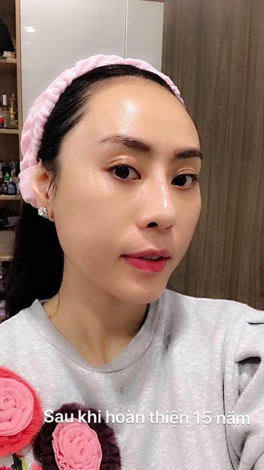 Mỹ nhân Hà Thành tiết lộ câu chuyện 15 năm phẫu thuật thẩm mỹ để xứng đôi với ông xã - 8