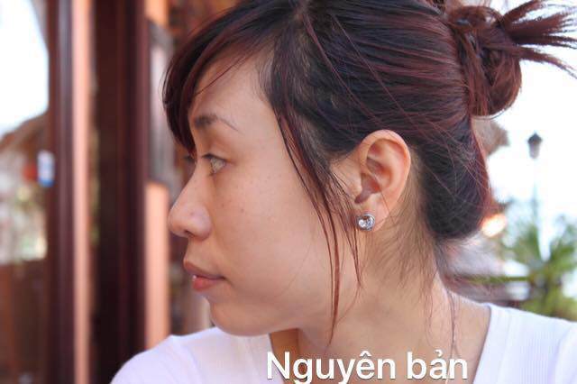 Mỹ nhân Hà Thành tiết lộ câu chuyện 15 năm phẫu thuật thẩm mỹ để xứng đôi với ông xã - 2