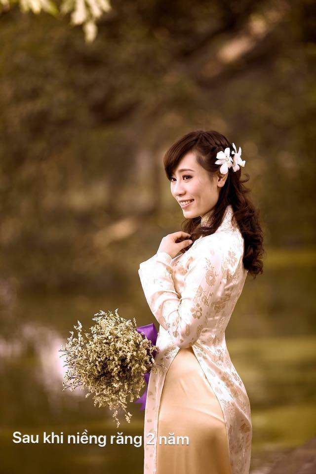 Mỹ nhân Hà Thành tiết lộ câu chuyện 15 năm phẫu thuật thẩm mỹ để xứng đôi với ông xã - 3
