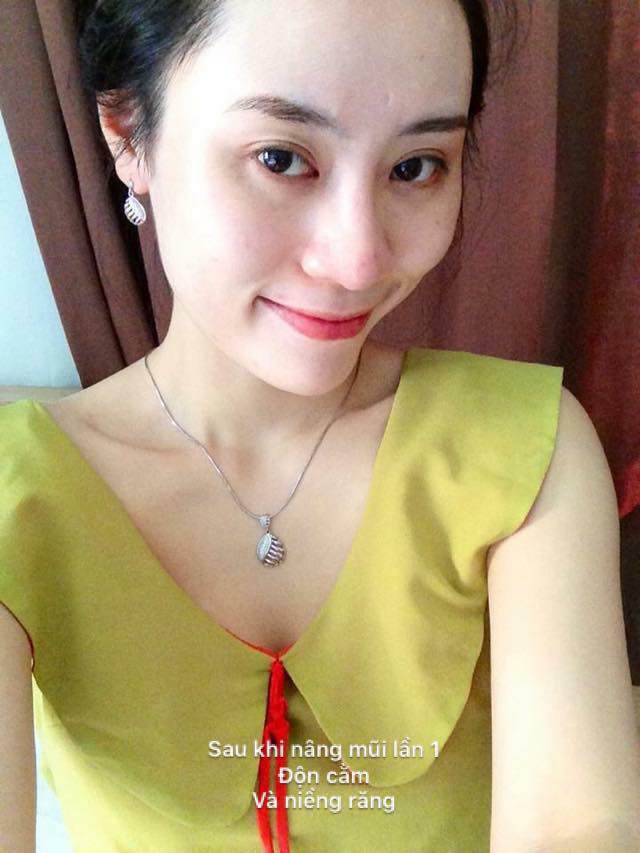 Mỹ nhân Hà Thành tiết lộ câu chuyện 15 năm phẫu thuật thẩm mỹ để xứng đôi với ông xã - 4