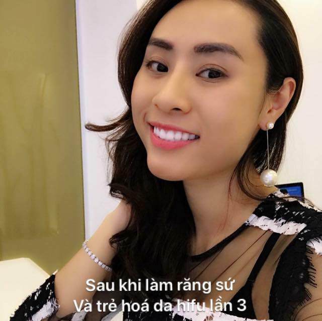 Mỹ nhân Hà Thành tiết lộ câu chuyện 15 năm phẫu thuật thẩm mỹ để xứng đôi với ông xã - 5