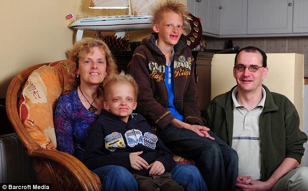 Những căn bệnh amp;#34;kỳ dịamp;#34; nhất thế giới mà toàn bộ giới y học cũng phải amp;#34;bó tayamp;#34; - 6