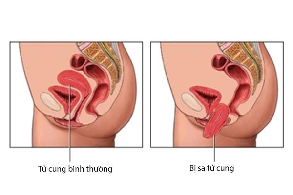 7. Kết Luận: Chăm Sóc Đau Dạ Con Sau Sinh Một Cách An Toàn và Hiệu Quả