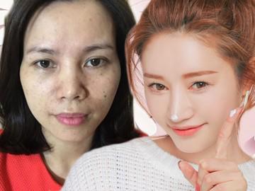 Trị nám hiệu quả từ trong ra ngoài với 3 loại mặt nạ giá dưới 10 nghìn!