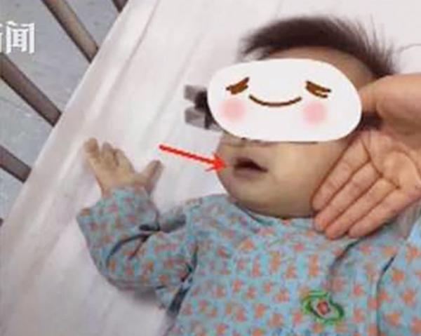 Trị chứng biếng ăn bằng nước bí đao ngâm 3 năm, mẹ vô tình khiến các con phải nhập viện - 1