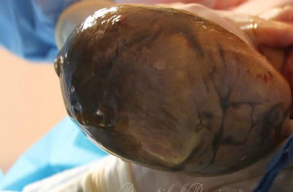 Ảnh hiếm hoi về các ca amp;#34;đẻ bọc điềuamp;#34;, được cho là em bé có số may mắn cả đời - 7