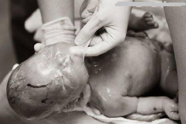 Ảnh hiếm hoi về các ca amp;#34;đẻ bọc điềuamp;#34;, được cho là em bé có số may mắn cả đời - 12