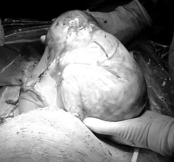 Ảnh hiếm hoi về các ca amp;#34;đẻ bọc điềuamp;#34;, được cho là em bé có số may mắn cả đời - 3