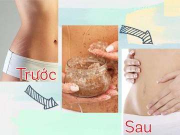 Rạn da đến mấy cũng sẽ trở nên mịn màng với 5 nguyên liệu có sẵn trong nhà!