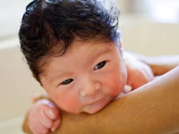 Cách trị rôm sảy cho trẻ sơ sinh tại nhà giúp bé dễ chịu, không quấy khóc