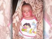 Làm mẹ - Cuộc sống của cô bé 6 tháng tuổi không tay chân bị bỏ rơi giờ ra sao?
