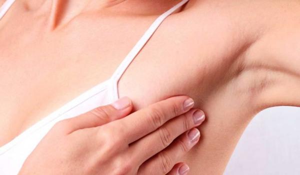 7 dấu hiệu thường thấy cảnh báo ung thư vú mà nhiều chị em hay bỏ qua - 2